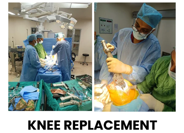 Knee Replacement